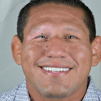 Dra Jen Ospina Estética Dental - Porcelain Veneers