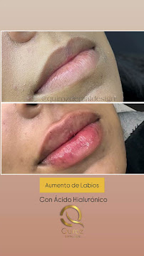 Diseño de sonrisa |Quiroz Dental | Odontologia