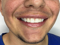 Diseño de sonrisa |Quiroz Dental | Odontologia