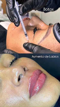 Diseño de sonrisa |Quiroz Dental | Odontologia