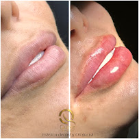 Diseño de sonrisa |Quiroz Dental | Odontologia