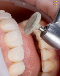 Diseño de sonrisa |Quiroz Dental | Odontologia