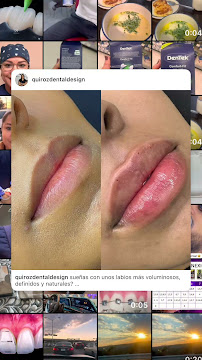 Diseño de sonrisa |Quiroz Dental | Odontologia
