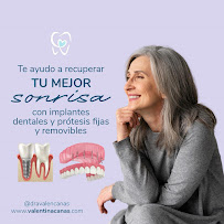 Dra. Valentina Cañas - Implantes Dentales en Cali