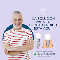Dra. Valentina Cañas - Implantes Dentales en Cali