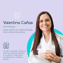 Dra. Valentina Cañas - Implantes Dentales en Cali