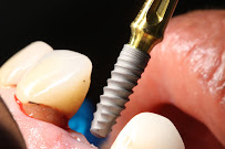 PerioDentic