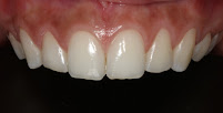 PerioDentic
