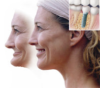 Dr. Czíner Dental Team | Zahnarzt Sopron Ungarn Zahnimplantat