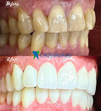 Crossroads Dental Clinic - Sheikh Zayed Road, Dubai
