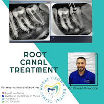 Royal Crown Dental Clinic