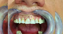 Royal Crown Dental Clinic