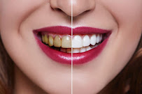 Pearly White Dental Clinic