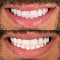 MyoSmile Polyclinic - Dental Clinic in Jumeirah