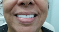 Veneers Dental Centre
