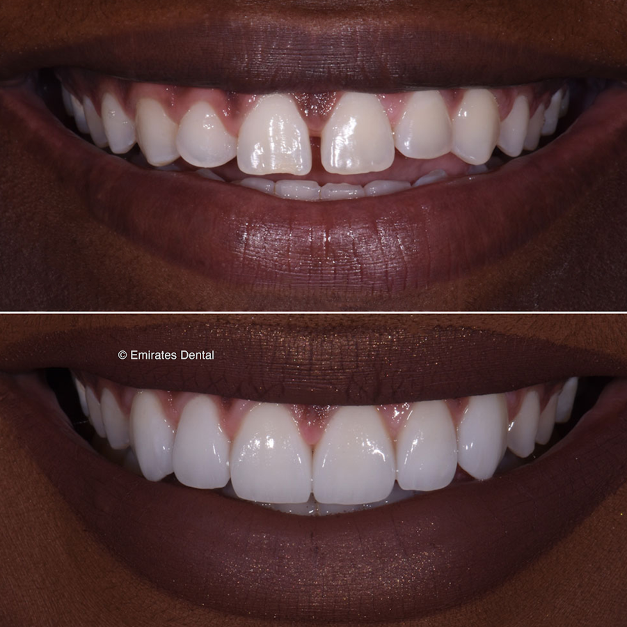 Emirates Dental