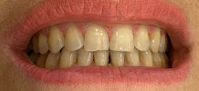 Emirates Dental - Cosmetic Dentistry & Invisalign Clinic Dubai