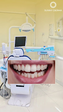 Sunny Dental Clinic ( Hollywood Smile - Veneers - فينير - ابتسامة هوليود - Aesthetic Dentist)