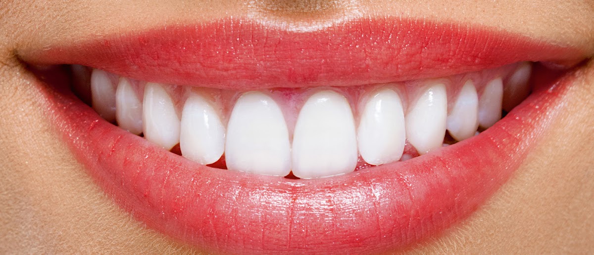 Al Najma Dental Clinic