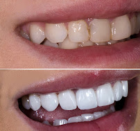 Al Najma Dental Clinic