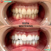 Al Jazeerah Dental Clinic