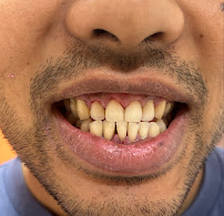 C-Dental Clinic (Caring for Smiles)
