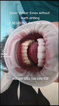 Manchester Medical Centre-Veneers, Implants & Invisalign Dentist in Sharjah