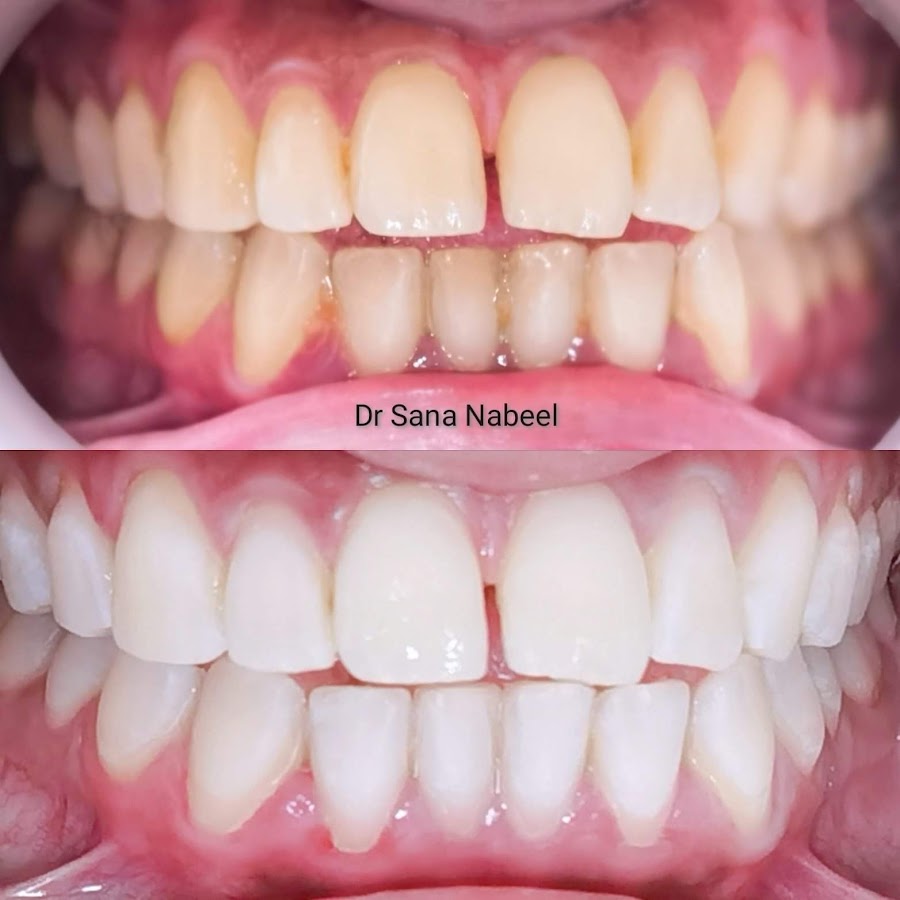 Elements Dental Centre - dental clinic in Sharjah
