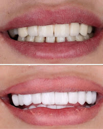 Almazoon Dentistry Clinic عيادة المزون للأسنان