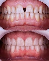 عيادة د. تغريد الطائي لطب الأسنان - Dr. Taghrid Al-Taie Dental Clinic