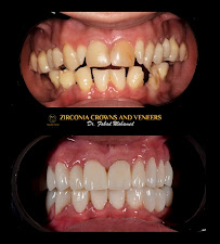 Smile First Dental Center