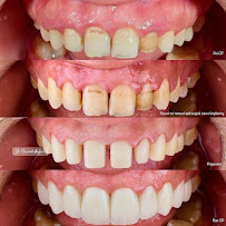 Aspetar Dental Clinic - Khalifa City