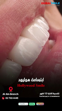 Dubai Smile Dental Clinic - Al Ain branch