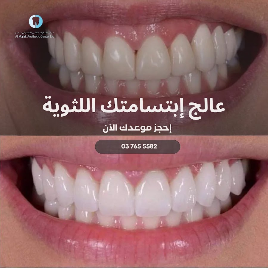 Al Malak Aesthetic Center