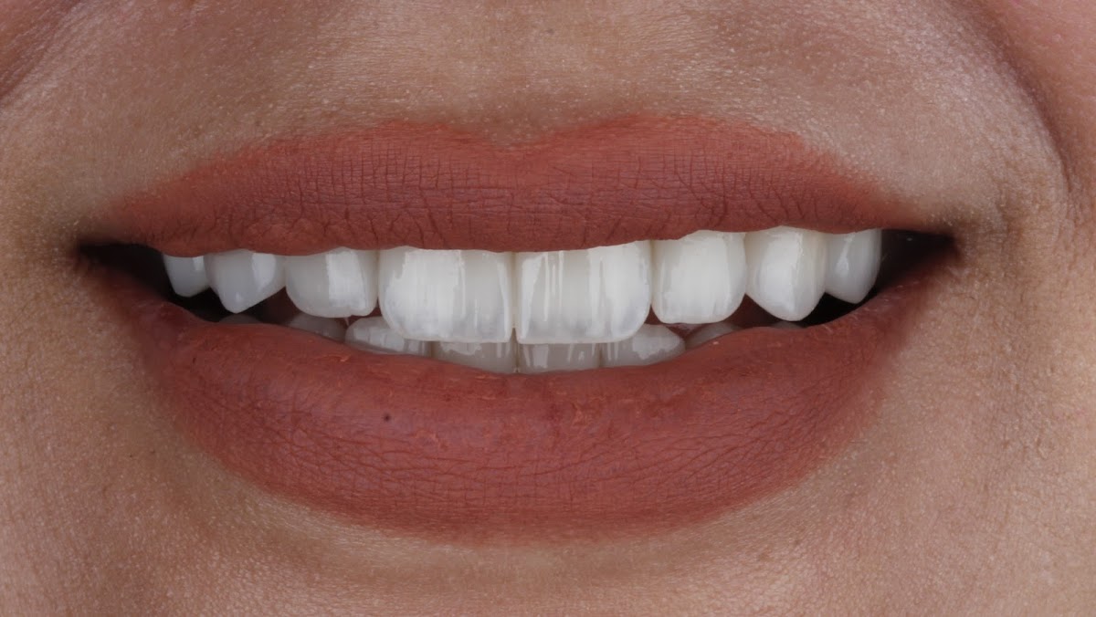 Dr. Bashar Kazaz Dental Clinic - dental clinic in Al Ain