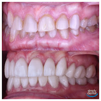 Simply Dental - Dentist in Los Algodones, B.C.
