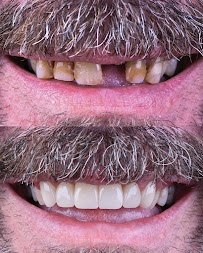 Simply Dental - Dentist in Los Algodones, B.C.