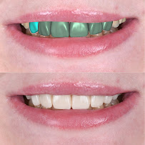 Simply Dental - Dentist in Los Algodones, B.C.
