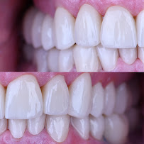Simply Dental - Dentist in Los Algodones, B.C.