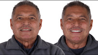 Novadent Dental Clinic - Dental Implants in los Algodones near Yuma AZ