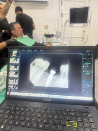 Novadent Dental Clinic - Dental Implants in los Algodones near Yuma AZ