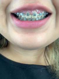 Smile Center Los Algodones