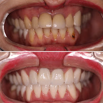 Smile Center Los Algodones