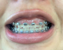 Smile Center Los Algodones