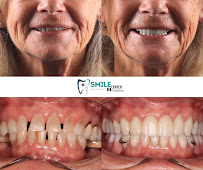 Smile Center Los Algodones
