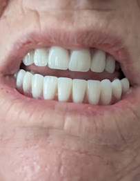 Smile Center Los Algodones