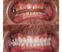 Smile Center Los Algodones