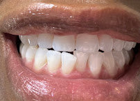 Alberta Dental