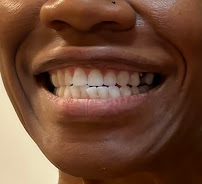 Alberta Dental