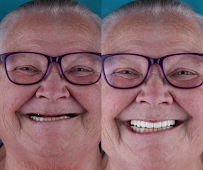 LOVAL Dental